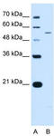 Potassium voltage-gated channel subfamily KQT member 2 antibody, TA338753, Origene, Western Blot image 