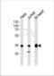 NADH:Ubiquinone Oxidoreductase Subunit A9 antibody, TA328120, Origene, Western Blot image 