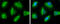 ATP Citrate Lyase antibody, GTX112387, GeneTex, Immunocytochemistry image 