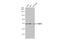 Protein Arginine Methyltransferase 5 antibody, GTX116004, GeneTex, Western Blot image 