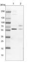 Coiled-Coil Domain Containing 181 antibody, NBP1-93901, Novus Biologicals, Western Blot image 