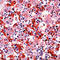 Alpha Fetoprotein antibody, LS-C88767, Lifespan Biosciences, Immunohistochemistry frozen image 