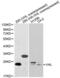 Von Hippel-Lindau disease tumor suppressor antibody, LS-C192272, Lifespan Biosciences, Western Blot image 
