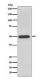 ATP Synthase F1 Subunit Beta antibody, M02937, Boster Biological Technology, Western Blot image 