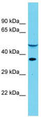 Dihydrouridine Synthase 4 Like antibody, TA331553, Origene, Western Blot image 
