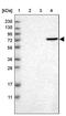 Hyaluronan Binding Protein 2 antibody, PA5-54009, Invitrogen Antibodies, Western Blot image 