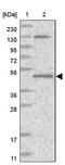 Queuine TRNA-Ribosyltransferase Accessory Subunit 2 antibody, PA5-57838, Invitrogen Antibodies, Western Blot image 