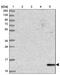 Eukaryotic Translation Initiation Factor 4E Binding Protein 3 antibody, PA5-61027, Invitrogen Antibodies, Western Blot image 