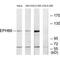 Ephrin type-B receptor 6 antibody, PA5-49763, Invitrogen Antibodies, Western Blot image 