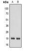 Interferon alpha-1 antibody, abx133758, Abbexa, Western Blot image 