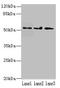 Protein Phosphatase 2 Regulatory Subunit Bbeta antibody, orb356187, Biorbyt, Western Blot image 