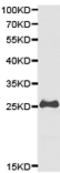 Glutathione S-transferase Mu 2 antibody, TA323547, Origene, Western Blot image 
