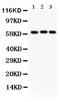 Heparanase antibody, PA5-79393, Invitrogen Antibodies, Western Blot image 
