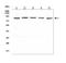DEAD-Box Helicase 1 antibody, A03727-1, Boster Biological Technology, Western Blot image 