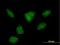 R3H Domain Containing 2 antibody, H00022864-B01P, Novus Biologicals, Immunofluorescence image 