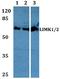 LIM domain kinase 1 antibody, A01323, Boster Biological Technology, Western Blot image 