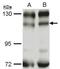 Phosphatidylinositol-4,5-bisphosphate 3-kinase catalytic subunit beta isoform antibody, GTX111173, GeneTex, Western Blot image 