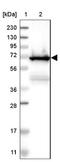 Lymphocyte Cytosolic Protein 1 antibody, NBP1-88057, Novus Biologicals, Western Blot image 