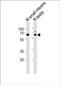 Nuclear Receptor Subfamily 5 Group A Member 2 antibody, PA5-49427, Invitrogen Antibodies, Western Blot image 