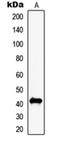 Melanoma-associated antigen C2 antibody, orb215177, Biorbyt, Western Blot image 