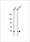 MEFV Innate Immuity Regulator, Pyrin antibody, 60-653, ProSci, Western Blot image 