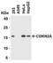 CDKN2A antibody, 8975, ProSci Inc, Western Blot image 