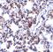B Cell Receptor Associated Protein 31 antibody, A03767, Boster Biological Technology, Immunohistochemistry paraffin image 