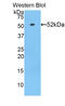 Bile acyl-CoA synthetase antibody, LS-C724154, Lifespan Biosciences, Western Blot image 