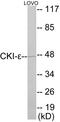 Casein Kinase 1 Epsilon antibody, EKC1729, Boster Biological Technology, Western Blot image 