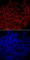 Glucosylceramidase Beta 3 (Gene/Pseudogene) antibody, MA5-24342, Invitrogen Antibodies, Immunocytochemistry image 