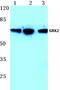 G Protein-Coupled Receptor Kinase 2 antibody, AP06430PU-N, Origene, Western Blot image 