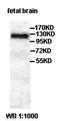HECT And RLD Domain Containing E3 Ubiquitin Protein Ligase 4 antibody, orb77694, Biorbyt, Western Blot image 