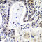 LSM2 Homolog, U6 Small Nuclear RNA And MRNA Degradation Associated antibody, 23-332, ProSci, Immunohistochemistry paraffin image 