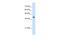 Interferon Induced Protein 44 Like antibody, A10975, Boster Biological Technology, Western Blot image 