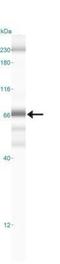 p65 antibody, NBP2-27416, Novus Biologicals, Western Blot image 