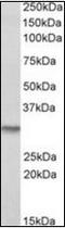 DT-diaphorase antibody, orb96455, Biorbyt, Western Blot image 