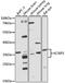 Potassium Voltage-Gated Channel Interacting Protein 1 antibody, STJ24294, St John