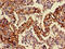 CD142 antibody, CSB-PA007928LA01HU, Cusabio, Immunohistochemistry paraffin image 