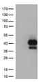 T Cell Immunoreceptor With Ig And ITIM Domains antibody, TA812567, Origene, Western Blot image 
