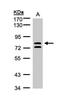 L3MBTL Histone Methyl-Lysine Binding Protein 1 antibody, NBP1-32447, Novus Biologicals, Western Blot image 