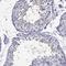 Cholinergic Receptor Nicotinic Beta 3 Subunit antibody, HPA045555, Atlas Antibodies, Immunohistochemistry frozen image 