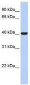 Hydroxy-Delta-5-Steroid Dehydrogenase, 3 Beta- And Steroid Delta-Isomerase 1 antibody, TA346232, Origene, Western Blot image 