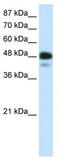 Neuronal Differentiation 2 antibody, TA329758, Origene, Western Blot image 