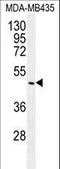 Growth Differentiation Factor 5 antibody, LS-C166428, Lifespan Biosciences, Western Blot image 
