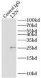 Latexin antibody, FNab04893, FineTest, Immunoprecipitation image 