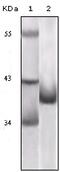 p16-INK4 antibody, 32-203, ProSci, Enzyme Linked Immunosorbent Assay image 