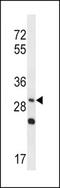 Protein Wnt-3a antibody, MBS9210359, MyBioSource, Western Blot image 