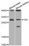 Von Hippel-Lindau Tumor Suppressor antibody, STJ113742, St John