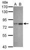 Chromodomain Y Like antibody, GTX117708, GeneTex, Western Blot image 