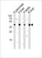 3-Hydroxy-3-Methylglutaryl-CoA Synthase 2 antibody, LS-B10703, Lifespan Biosciences, Western Blot image 